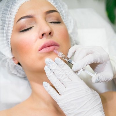 Lip Fillers in Dubai