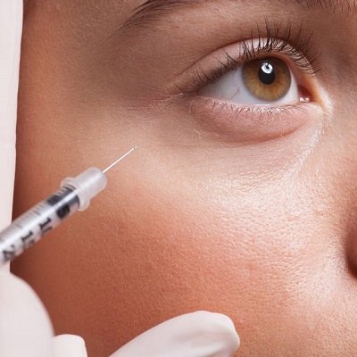 undereye filler treatment in dubai